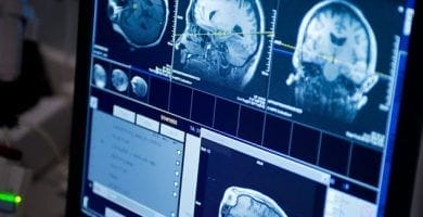 Cáncer Cerebral: La Ia Acelera El Tratamiento. Descubre Cómo Reducir Días De Prueba